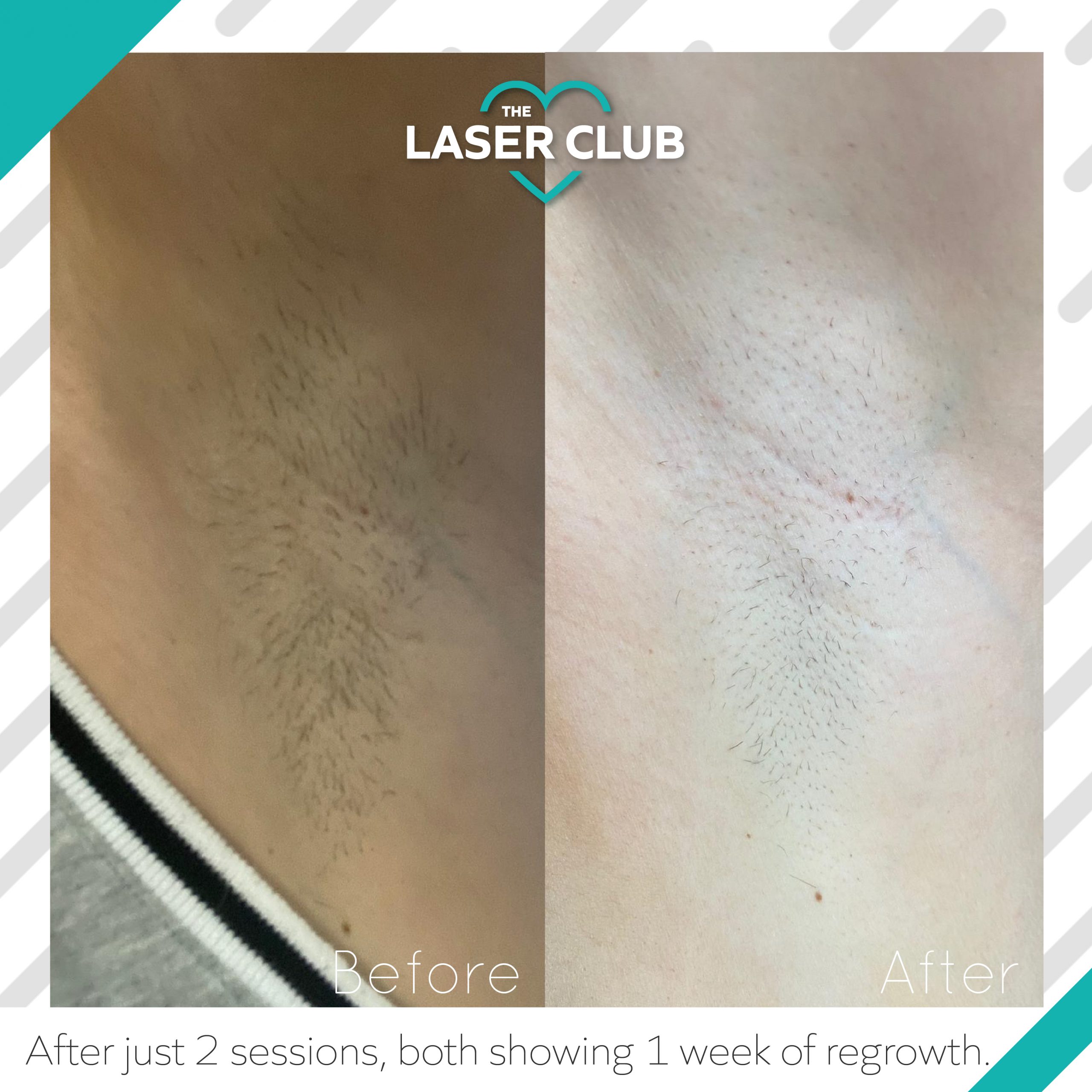 Laser-Club-Instagram-Feed-22-1-scaled
